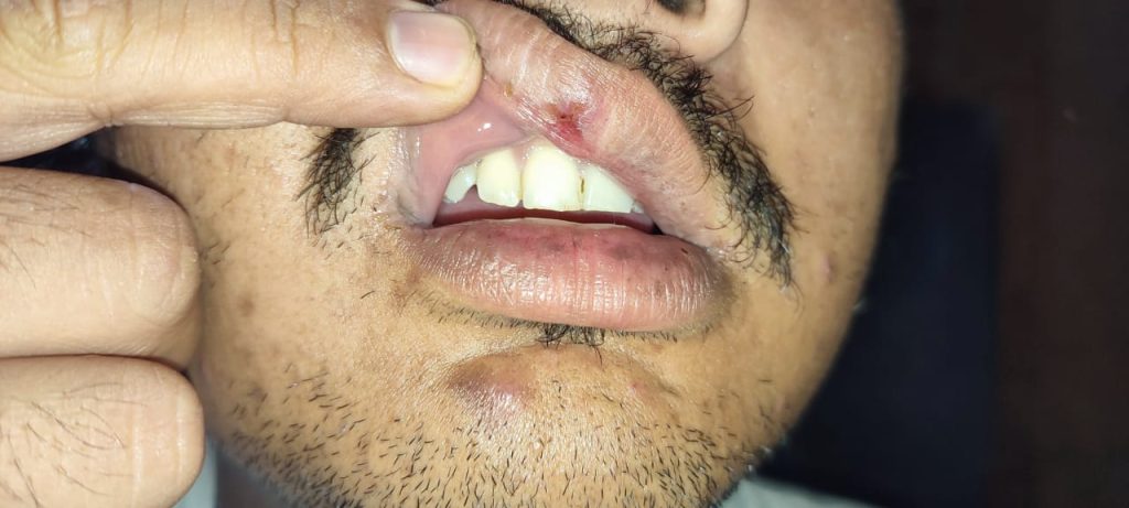 diduga penganiayaan